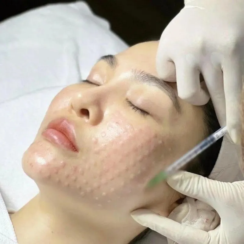 ADN de Salmón PDRN. Regeneración celular avanzada