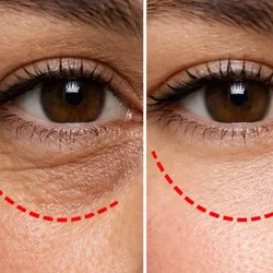 Ami Eyes contorno de ojos y ojeras 