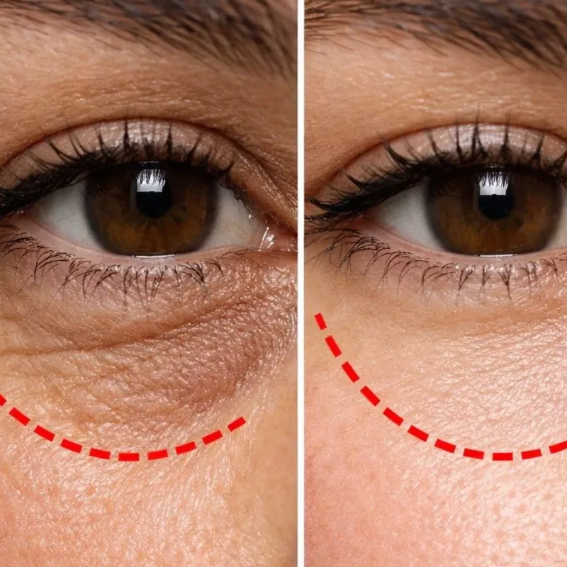 Ami Eyes contorno de ojos y ojeras