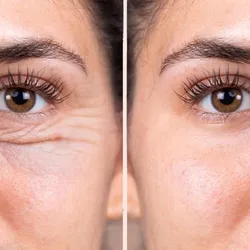 Ami Eyes contorno de ojos y ojeras 