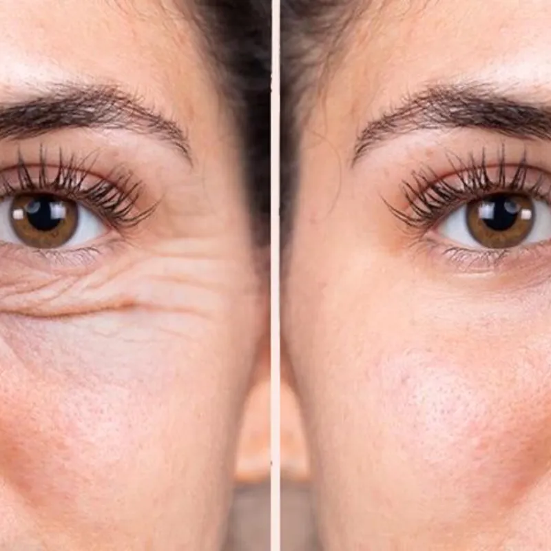 Ami Eyes contorno de ojos y ojeras 