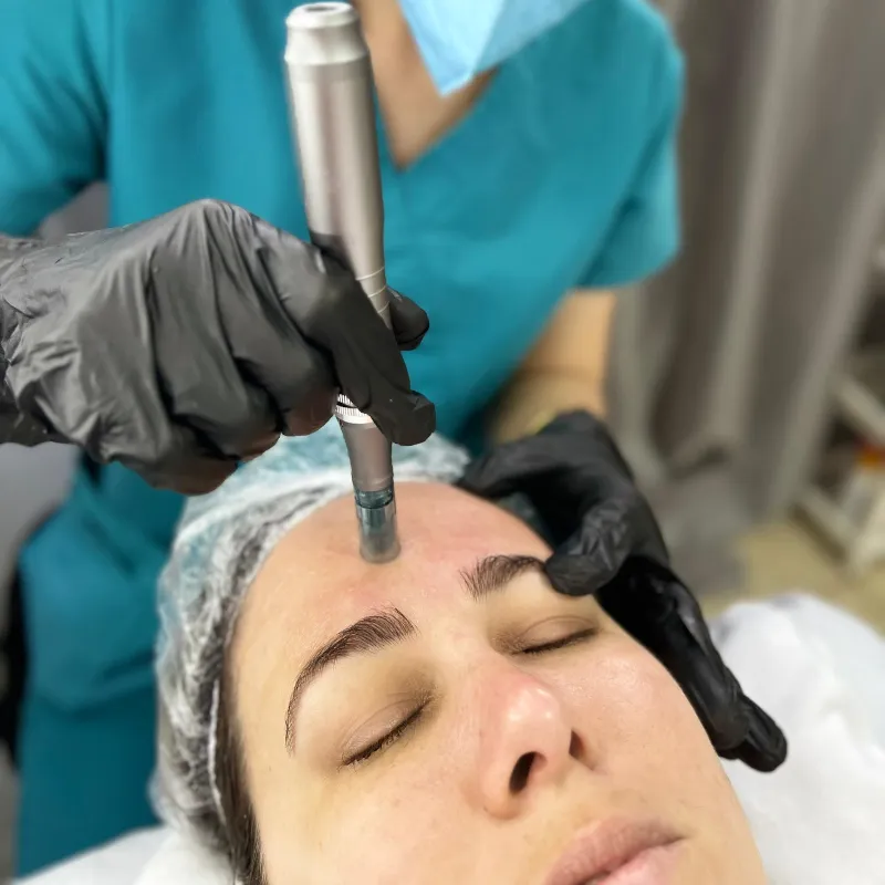 Dermaplaning