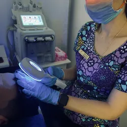Microneedling Capilar