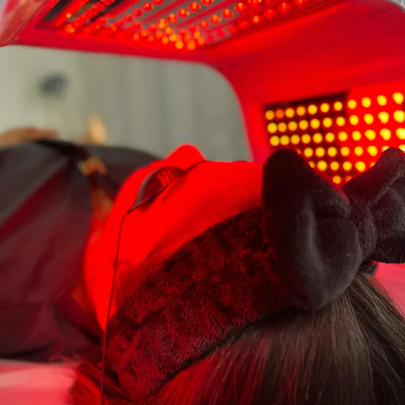 Microneedling (Dermapen)