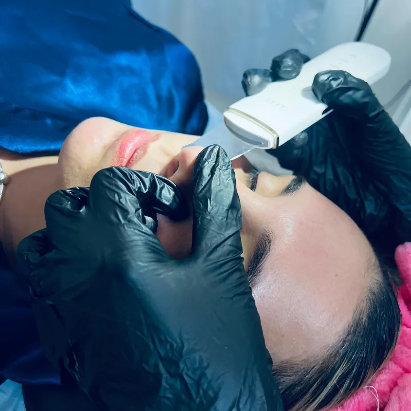 Microneedling (Dermapen)