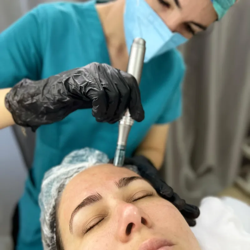 Microneedling (Dermapen)
