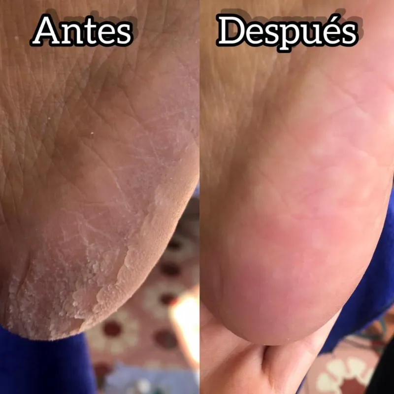 Pedicure Profundo + Esmaltado