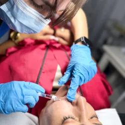 Relleno de Arrugas y Surcos Con ácido Hialurónico