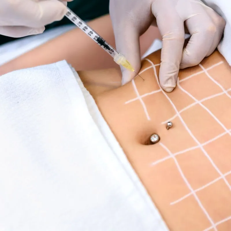 Tratamiento para Grasa Localizada 