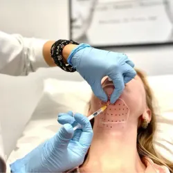 Tratamiento reductor de papada