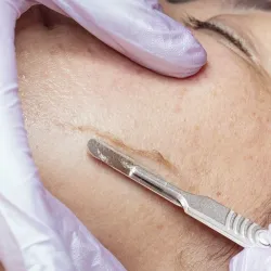 Limpieza Facial con Dermaplaning
