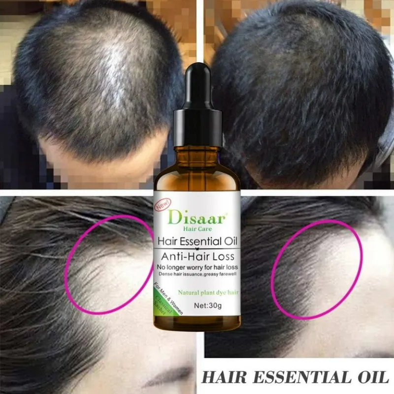 Aceite esencial para el cabello  Anticaída