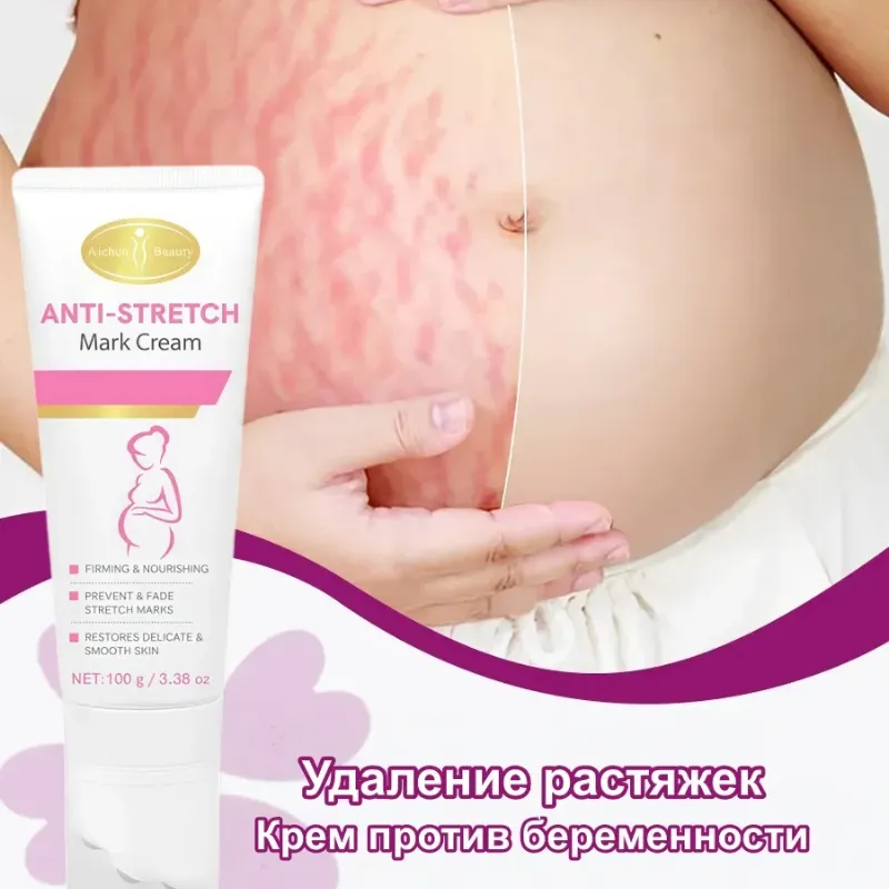 Aichun Beauty – Crema multiacción antiestrías con masajeador roller