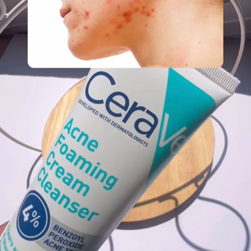 CeraVe Crema limpiadora espumosa para el acné (150ml)