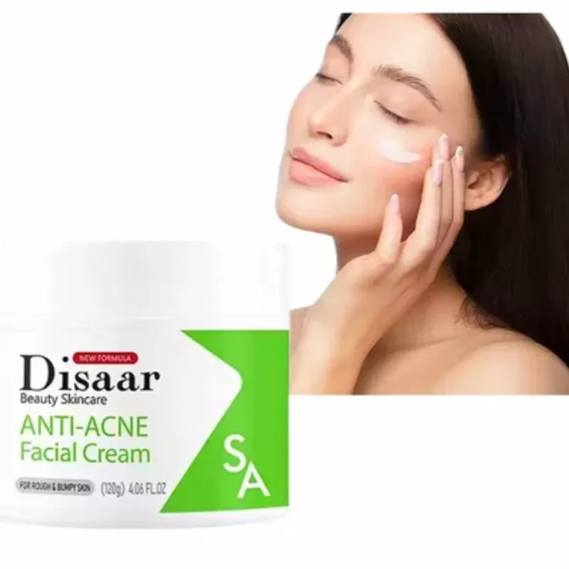 Crema facial anti-acné  , Blanqueador ,reparador y atenuador de marcas de acné. Antiinflamatorio e hidratante.(200g)