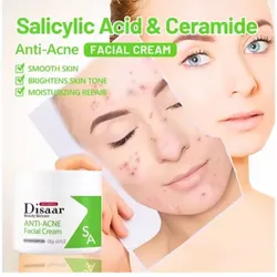 Crema facial anti-acné  , Blanqueador ,reparador y atenuador de marcas de acné. Antiinflamatorio e hidratante.(200g)