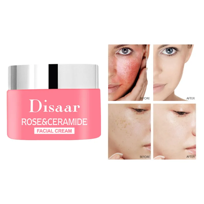 🌺Crema Rosas Disaar( 50g)