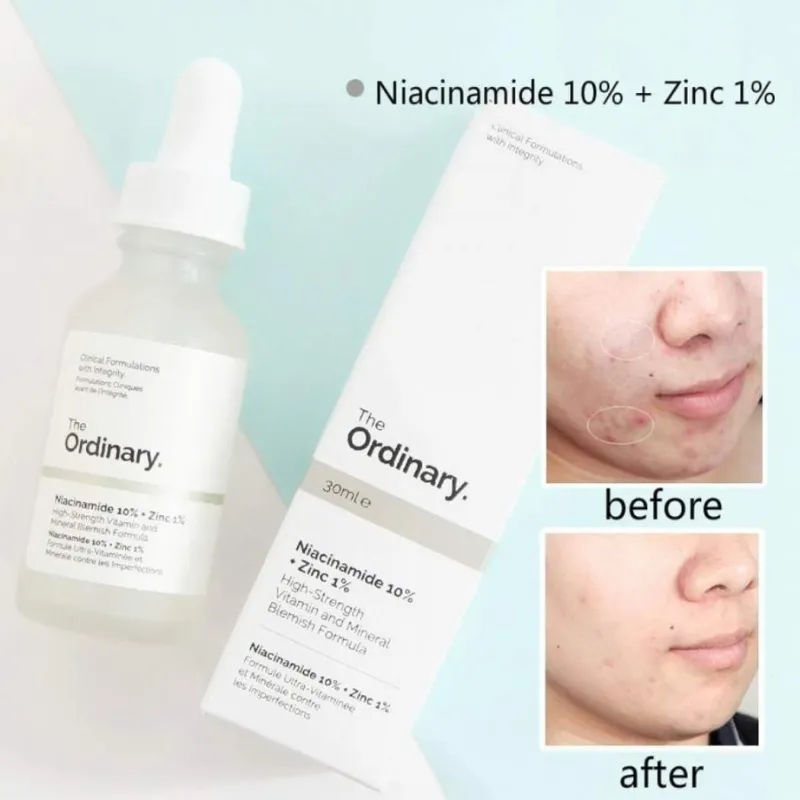 Niacinamida10%+Zinc 1% The Ordinary (30ml)