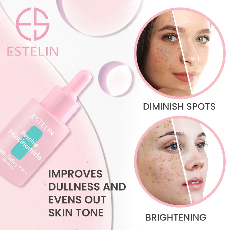 Serums facial despigmentante de  Niacinamida 