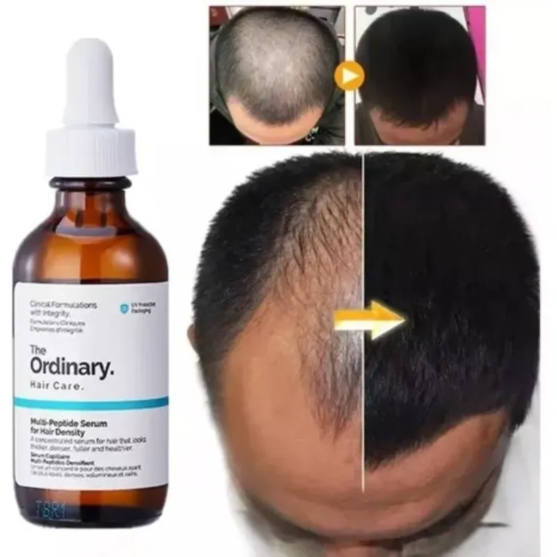 Suero multipéptido The Ordinary 60 ml para la densidad del cabello