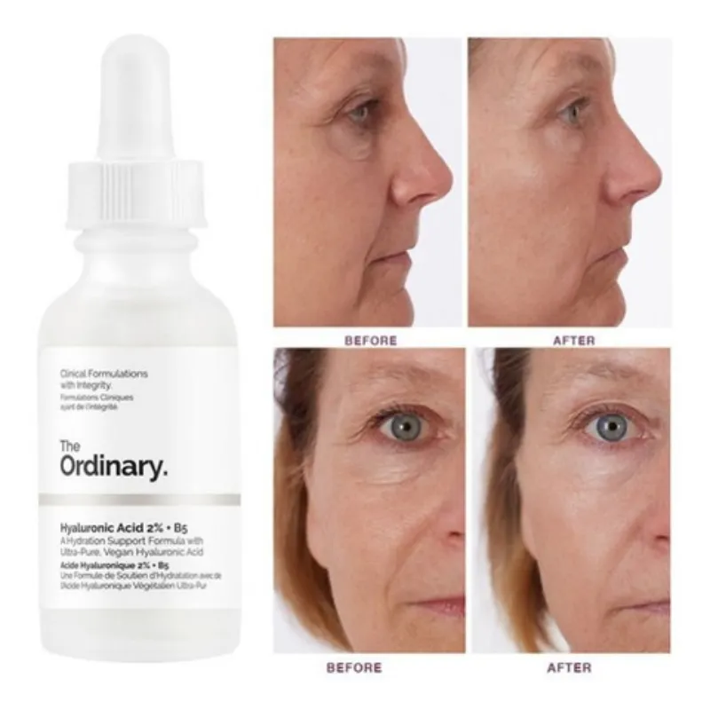 THE ORDINARY HYALURONIC ACID 2% + B5  30ML