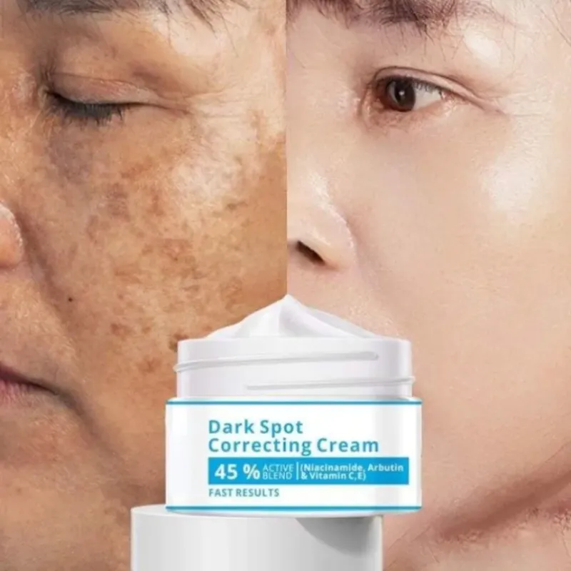Crema Correctora de Puntos Negros