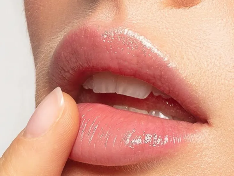 Labios