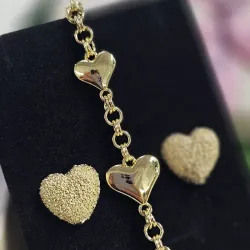 Aretes