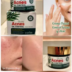 🌿 Crema Facial Anti-Acné y Control Grasa de Árbol de Tea 🌿