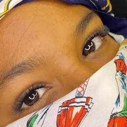 Ojo de gato 