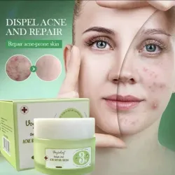 Crema facial ácido salicílico