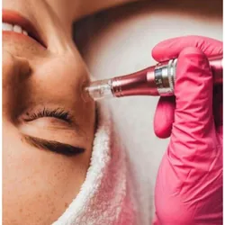 Dermapen (Microneedling)