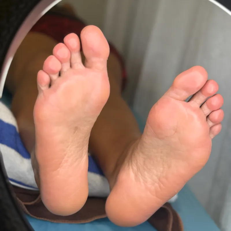 Limpieza y pulido de calcañales profunda con eliminación de callosidades 