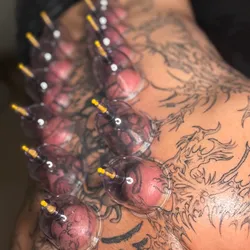 Masaje de Tejido Profundo con Ventosas