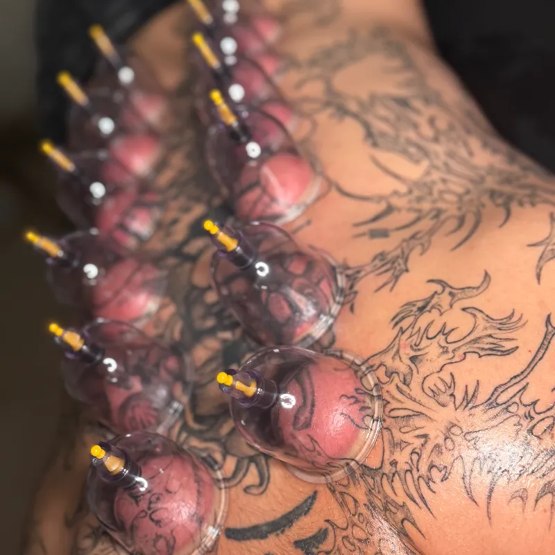 Masaje de Tejido Profundo con Ventosas