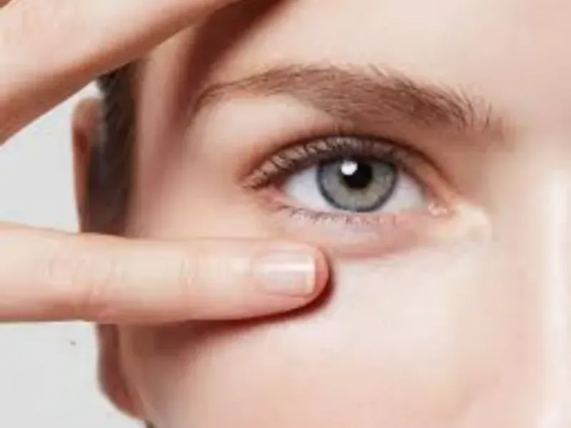 Contorno de ojos 