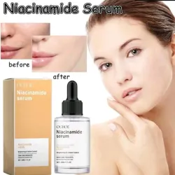 🧡Sérum de niacinamida 10%+Nac8%🧡