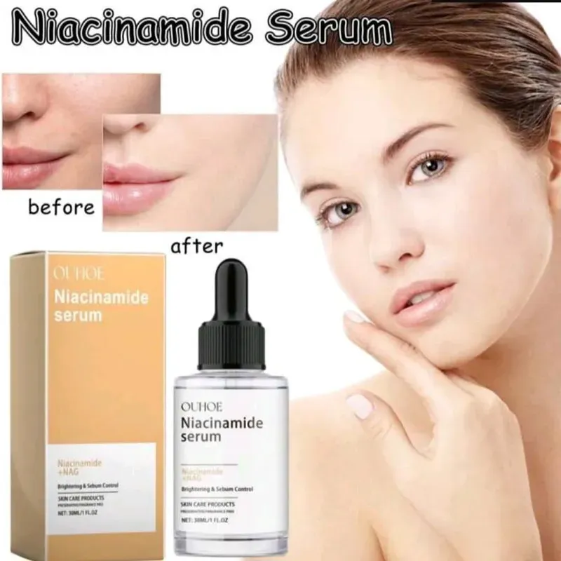 🧡Sérum de niacinamida 10%+Nac8%🧡