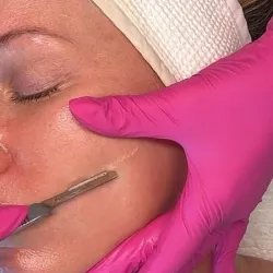 Dermaplaning Facial