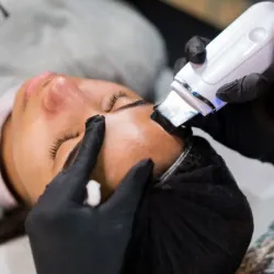 Peeling Ultrasónico