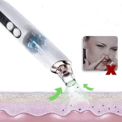 Succión Ultrasónica