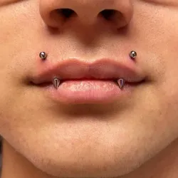Angel Bites