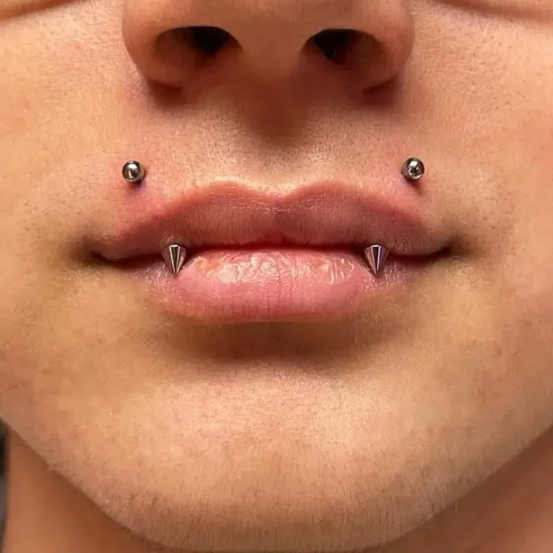 Angel Bites