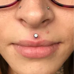 Medusa (Philtrum)