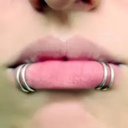 Shark Bites