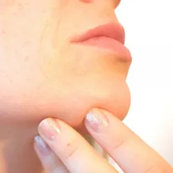 Depilación de barbilla✨️