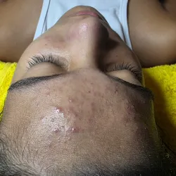 Masaje relajante en cara