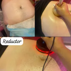 Tratamiento combinado