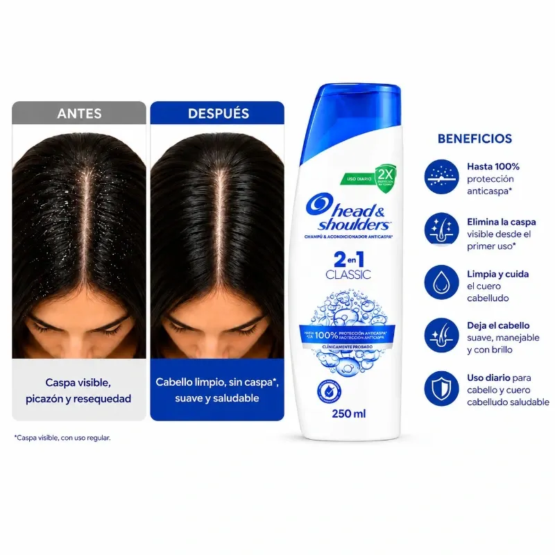 Head & Shoulders 2 en 1 Classic