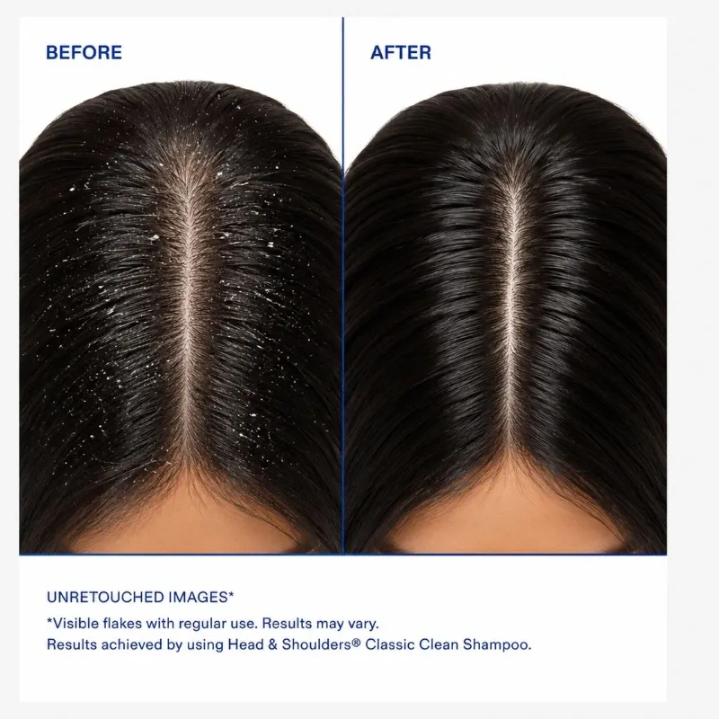 Head & Shoulders Classic Anticaspa